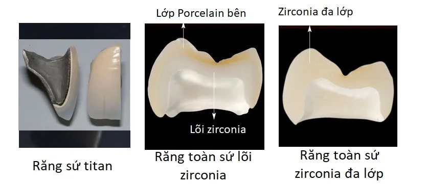 Some materials used for making porcelain crowns.
