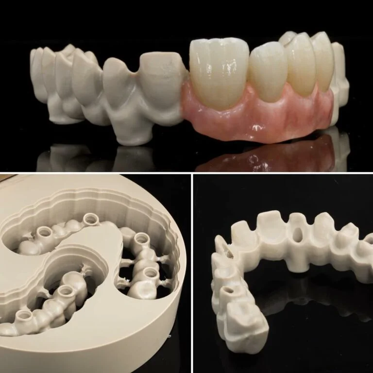 all on 4 dental implants vietnam