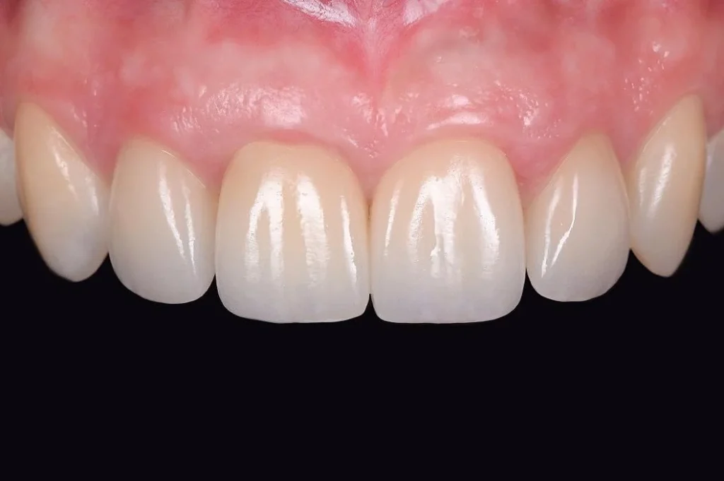 is dental tourism safe