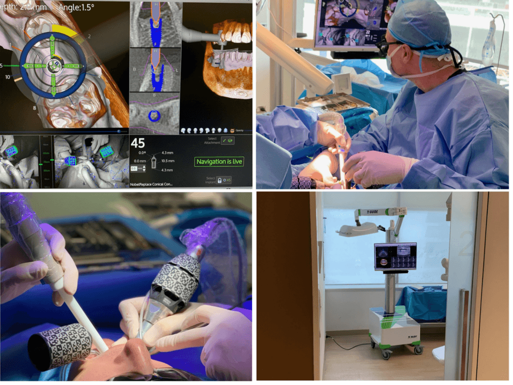 Dental Implant Vietnam