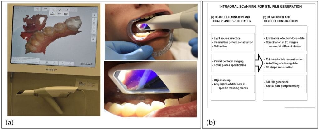 Dental Implant Vietnam