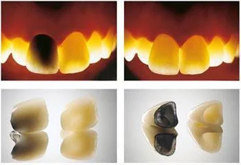 Light transmission comparison