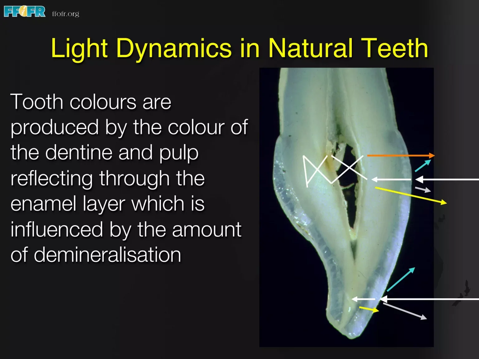 Color, translucency, and optical properties of natural teeth