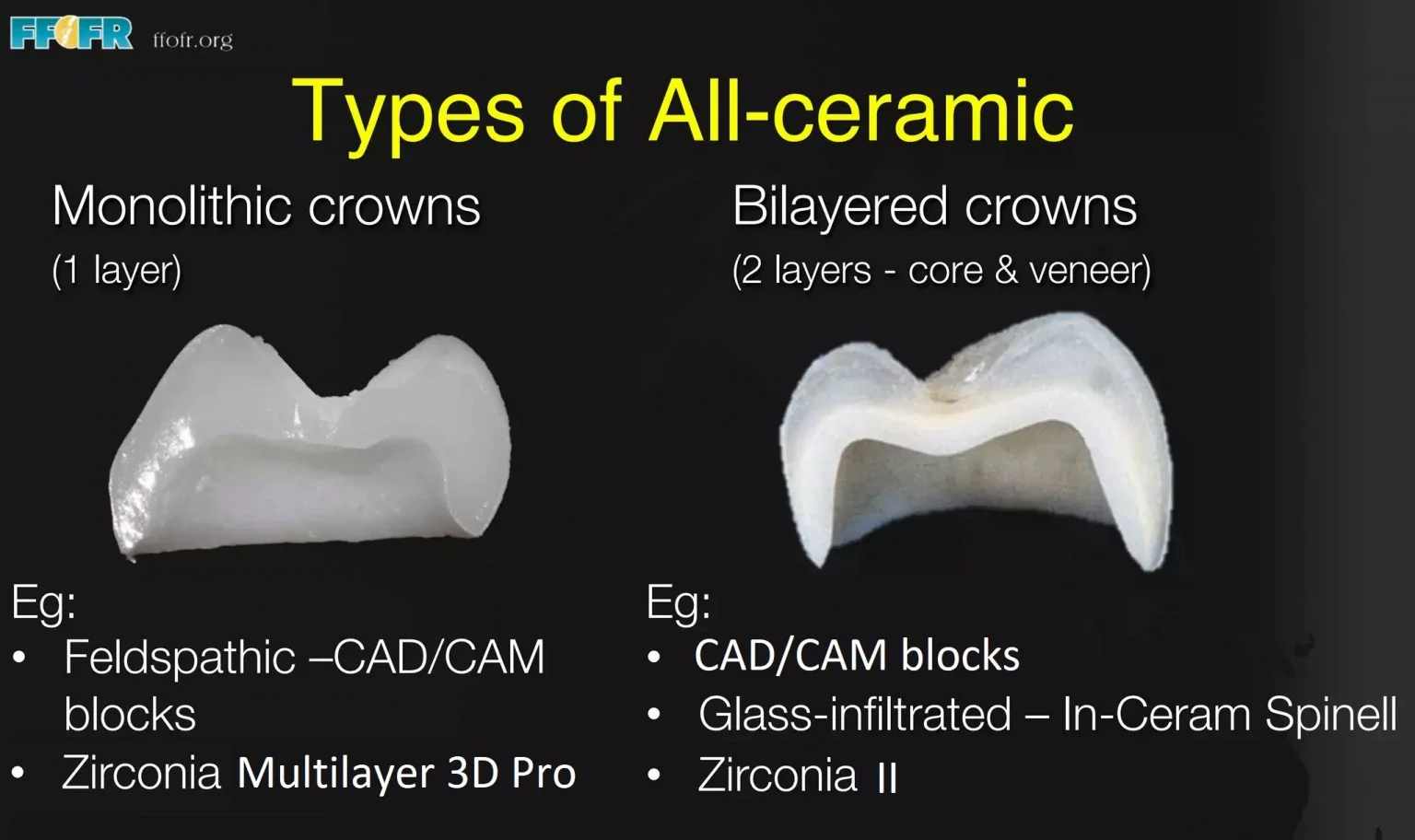 Multilayer zirconia vs zirconia-core crowns