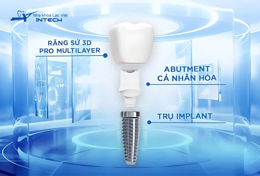 Personalized dental implants are currently the best method for restoring teeth.