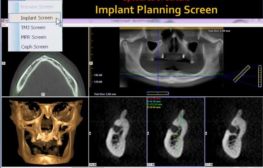 best dental implant clinic Vietnam