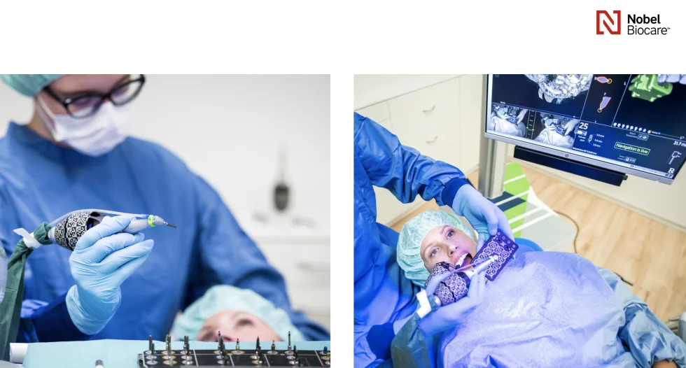 The X-guide surgical machine is available at Lac Viet Intech Dental Clinic.